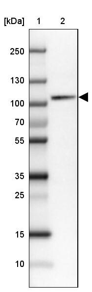 SATB2 Antibody (CL0321) - Azide and BSA Free Western Blot: SATB2 Antibody [NBP3-43949]