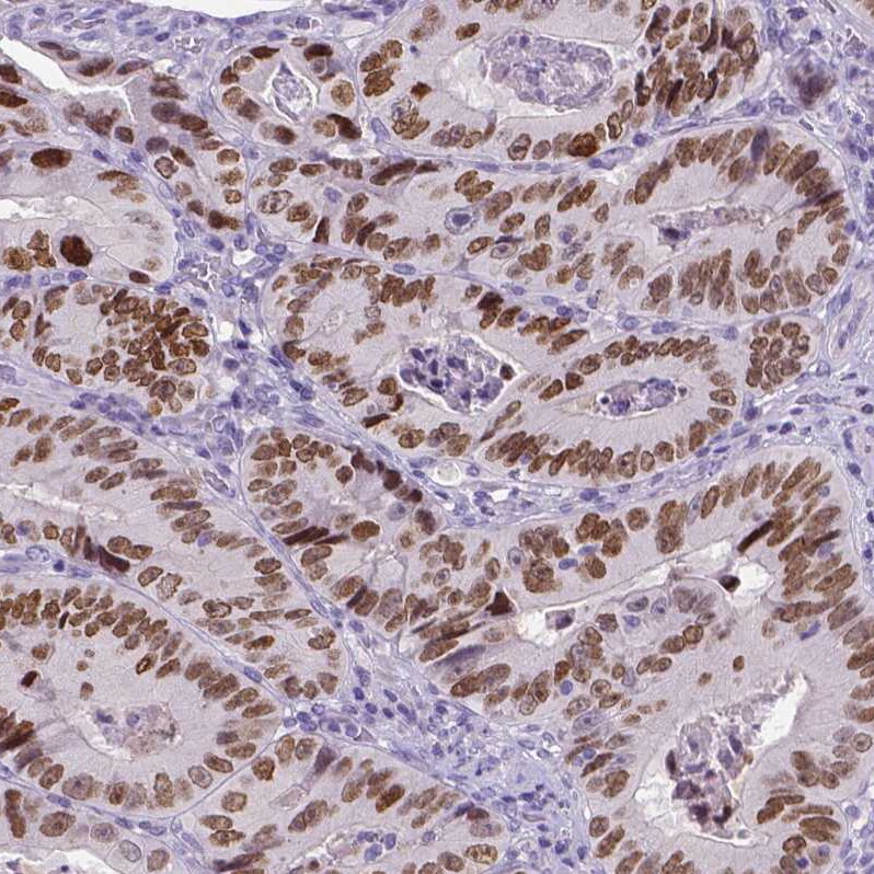 SATB2 Antibody (CL0321) - Azide and BSA Free Immunohistochemistry-Paraffin: SATB2 Antibody [NBP3-43949]
