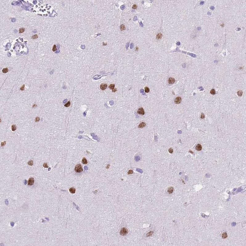 SATB2 Antibody (CL0321) - Azide and BSA Free Immunohistochemistry-Paraffin: SATB2 Antibody [NBP3-43949]