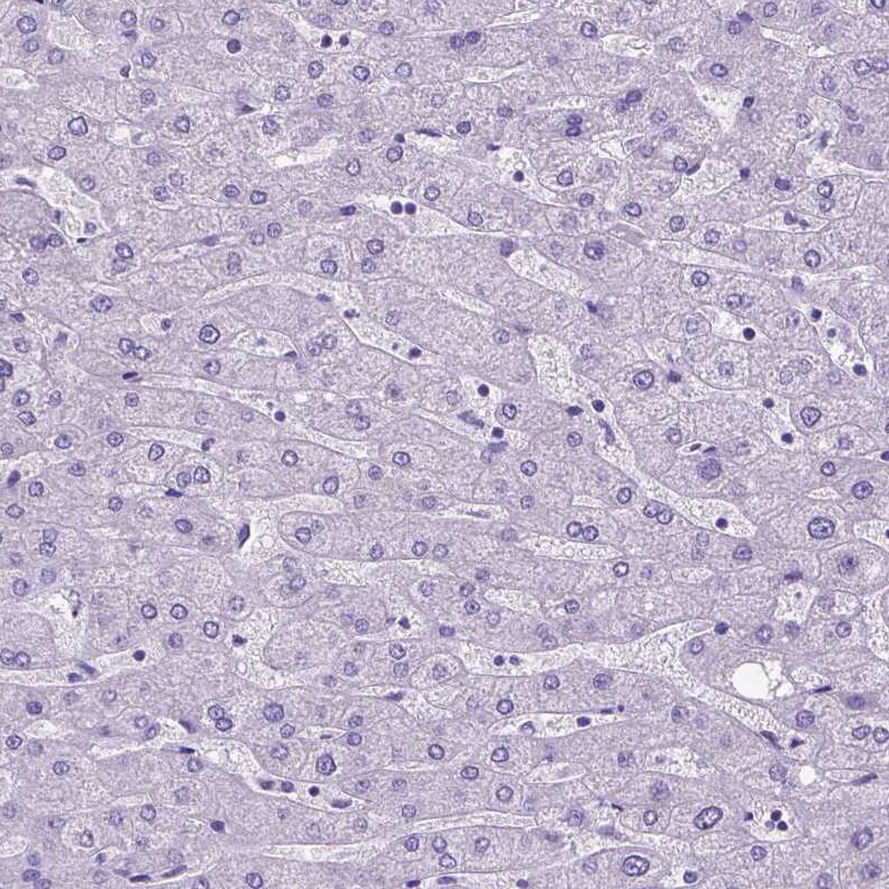 SATB2 Antibody (CL0321) - Azide and BSA Free Immunohistochemistry-Paraffin: SATB2 Antibody [NBP3-43949]