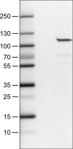 SATB2 Antibody (CL0321) - Azide and BSA Free Western Blot: SATB2 Antibody [NBP3-43949]