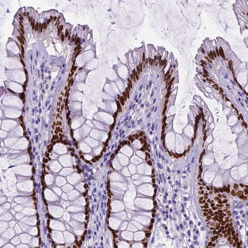SATB2 Antibody (CL0321) - Azide and BSA Free Immunohistochemistry-Paraffin: SATB2 Antibody [NBP3-43949]