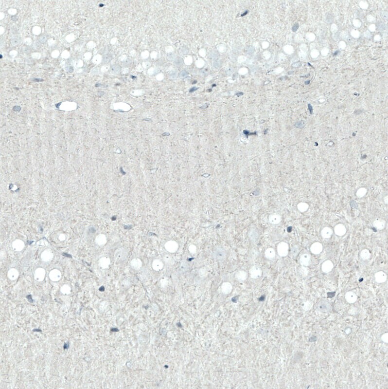 SATB2 Antibody (CL0321) - Azide and BSA Free Immunohistochemistry-Paraffin: SATB2 Antibody [NBP3-43949]