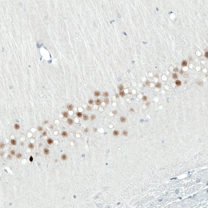 SATB2 Antibody (CL0321) - Azide and BSA Free Immunohistochemistry-Paraffin: SATB2 Antibody [NBP3-43949]