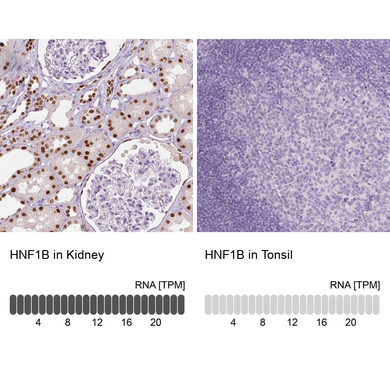 TCF-2/HNF-1 beta Antibody (CL0374) - Azide and BSA Free Immunohistochemistry-Paraffin: TCF-2/HNF-1 beta Antibody [NBP3-43951]