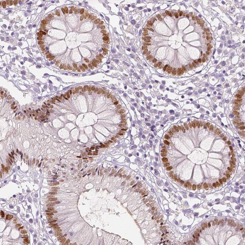 TCF-2/HNF-1 beta Antibody (CL0374) - Azide and BSA Free Immunohistochemistry-Paraffin: TCF-2/HNF-1 beta Antibody [NBP3-43951]