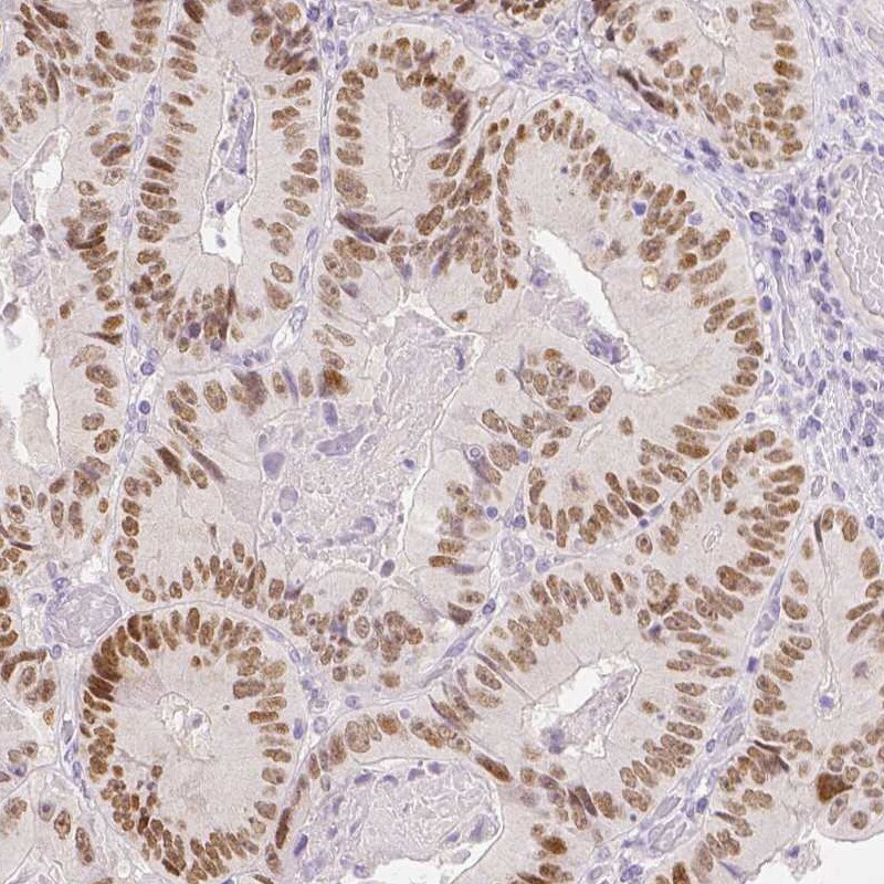 TCF-2/HNF-1 beta Antibody (CL0374) - Azide and BSA Free Immunohistochemistry-Paraffin: TCF-2/HNF-1 beta Antibody [NBP3-43951]