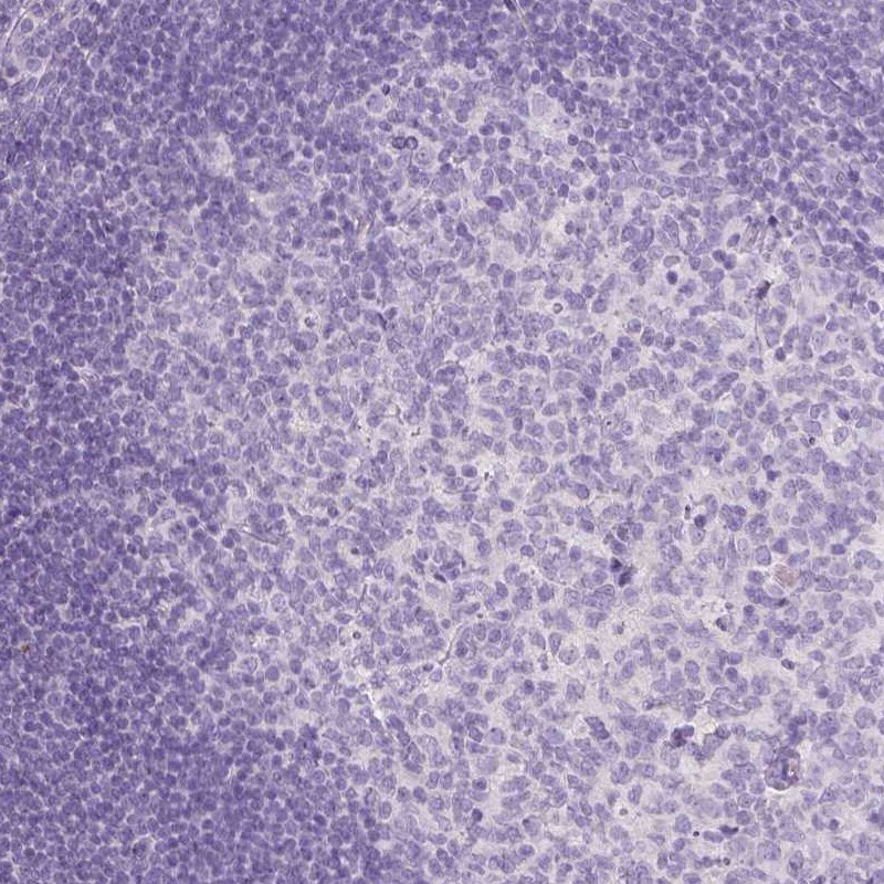 TCF-2/HNF-1 beta Antibody (CL0374) - Azide and BSA Free Immunohistochemistry-Paraffin: TCF-2/HNF-1 beta Antibody [NBP3-43951]