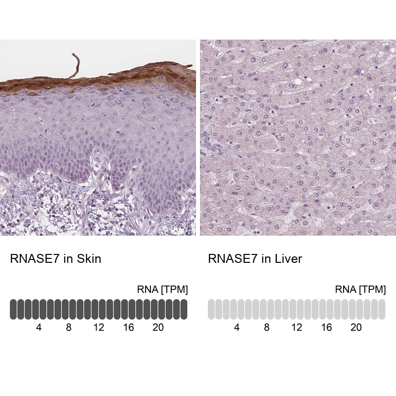 RNASE7 Antibody (CL0223) - Azide and BSA Free Immunohistochemistry-Paraffin: RNASE7 Antibody [NBP3-43952]