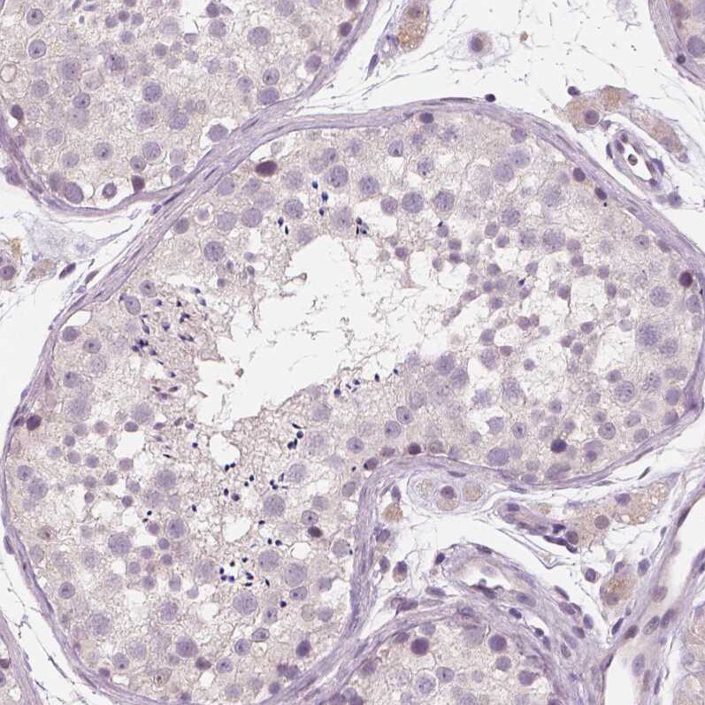 RNASE7 Antibody (CL0223) - Azide and BSA Free Immunohistochemistry-Paraffin: RNASE7 Antibody [NBP3-43952]