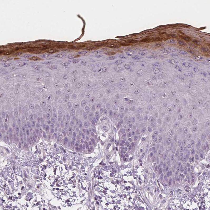RNASE7 Antibody (CL0223) - Azide and BSA Free Immunohistochemistry-Paraffin: RNASE7 Antibody [NBP3-43952]