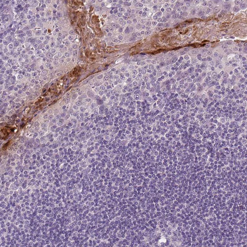 RNASE7 Antibody (CL0223) - Azide and BSA Free Immunohistochemistry-Paraffin: RNASE7 Antibody [NBP3-43952]