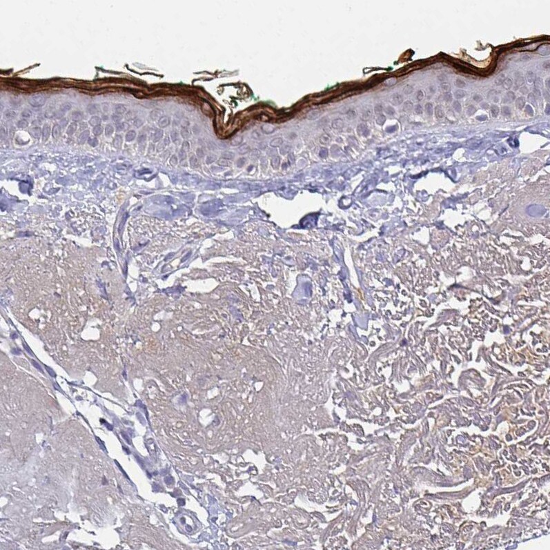 RNASE7 Antibody (CL0224) - Azide and BSA Free Immunohistochemistry-Paraffin: RNASE7 Antibody [NBP3-43953]
