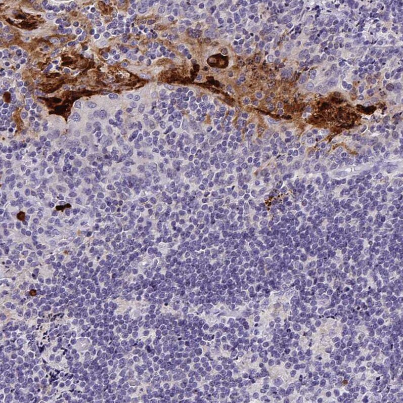 RNASE7 Antibody (CL0224) - Azide and BSA Free Immunohistochemistry-Paraffin: RNASE7 Antibody [NBP3-43953]