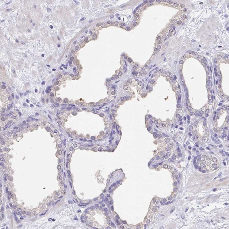 RNASE7 Antibody (CL0224) - Azide and BSA Free Immunohistochemistry-Paraffin: RNASE7 Antibody [NBP3-43953]
