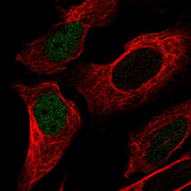 p53 Antibody (CL2199) - Azide and BSA Free Immunocytochemistry/ Immunofluorescence: p53 Antibody [NBP3-43954]