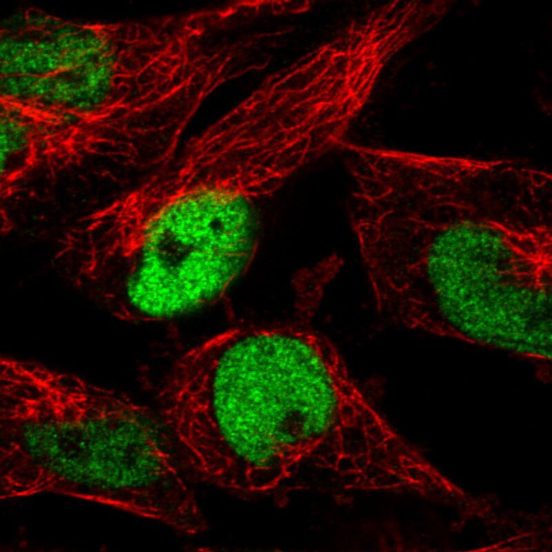 p53 Antibody (CL2199) - Azide and BSA Free Immunocytochemistry/ Immunofluorescence: p53 Antibody [NBP3-43954]