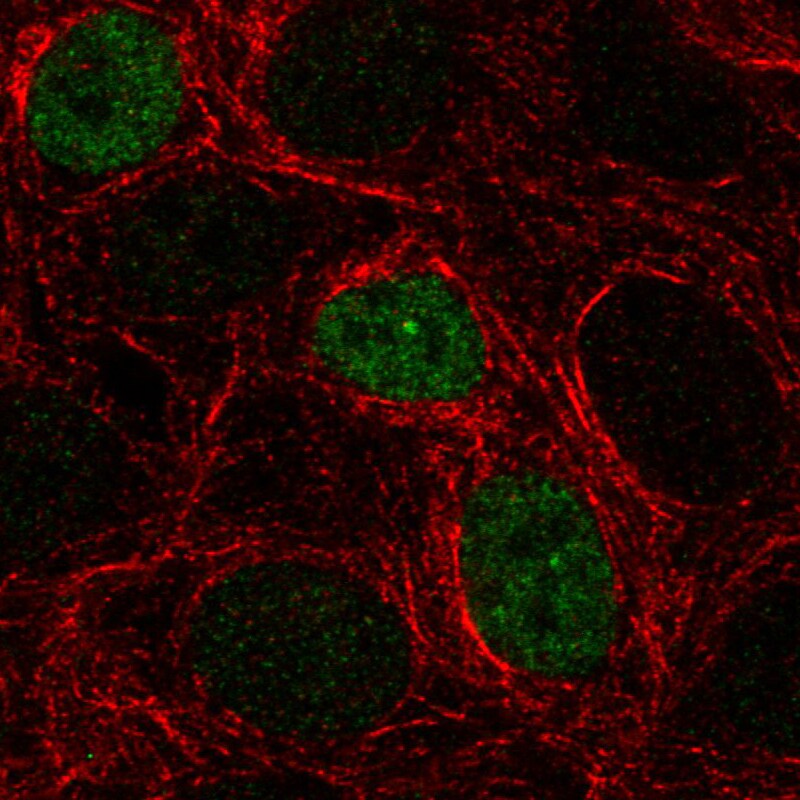p53 Antibody (CL2199) - Azide and BSA Free Immunocytochemistry/ Immunofluorescence: p53 Antibody [NBP3-43954]
