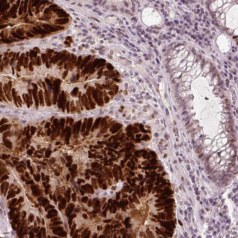 p53 Antibody (CL2199) - Azide and BSA Free Immunohistochemistry-Paraffin: p53 Antibody [NBP3-43954]