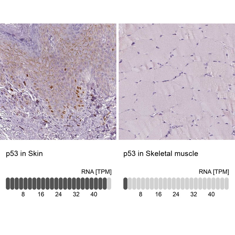 p53 Antibody (CL2199) - Azide and BSA Free Immunohistochemistry-Paraffin: p53 Antibody [NBP3-43954]