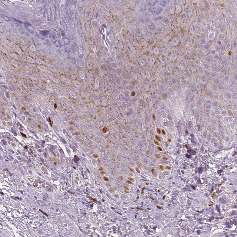 p53 Antibody (CL2199) - Azide and BSA Free Immunohistochemistry-Paraffin: p53 Antibody [NBP3-43954]