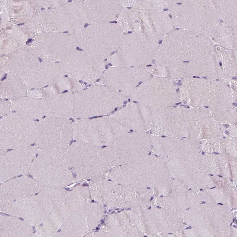 p53 Antibody (CL2199) - Azide and BSA Free Immunohistochemistry-Paraffin: p53 Antibody [NBP3-43954]