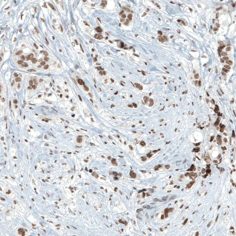 BAF180/PB1 Antibody (CL0331) - Azide and BSA Free Immunohistochemistry-Paraffin: BAF180/PB1 Antibody [NBP3-43955]