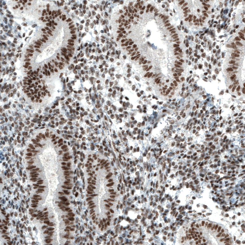 BAF180/PB1 Antibody (CL0331) - Azide and BSA Free Immunohistochemistry-Paraffin: BAF180/PB1 Antibody [NBP3-43955]