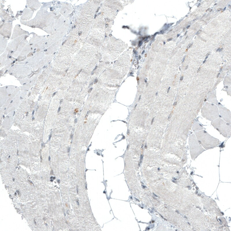 BAF180/PB1 Antibody (CL0331) - Azide and BSA Free Immunohistochemistry-Paraffin: BAF180/PB1 Antibody [NBP3-43955]