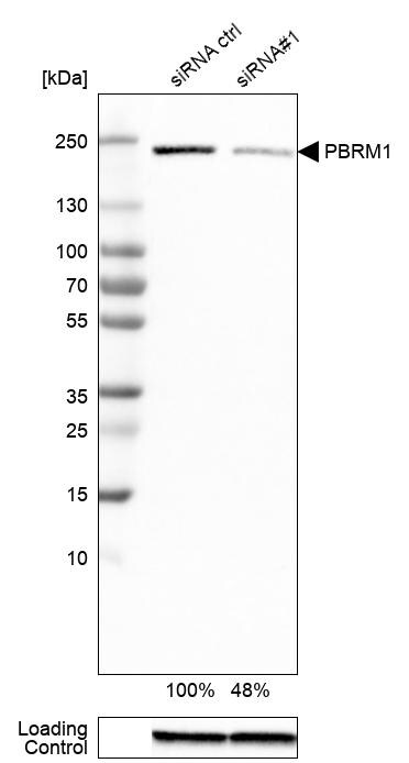 BAF180/PB1 Antibody (CL0331) - Azide and BSA Free Western Blot: BAF180/PB1 Antibody [NBP3-43955]