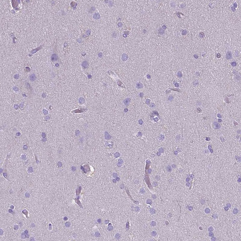 CD40/TNFRSF5 Antibody (CL1673) - Azide and BSA Free Immunohistochemistry-Paraffin: CD40/TNFRSF5 Antibody [NBP3-43956]
