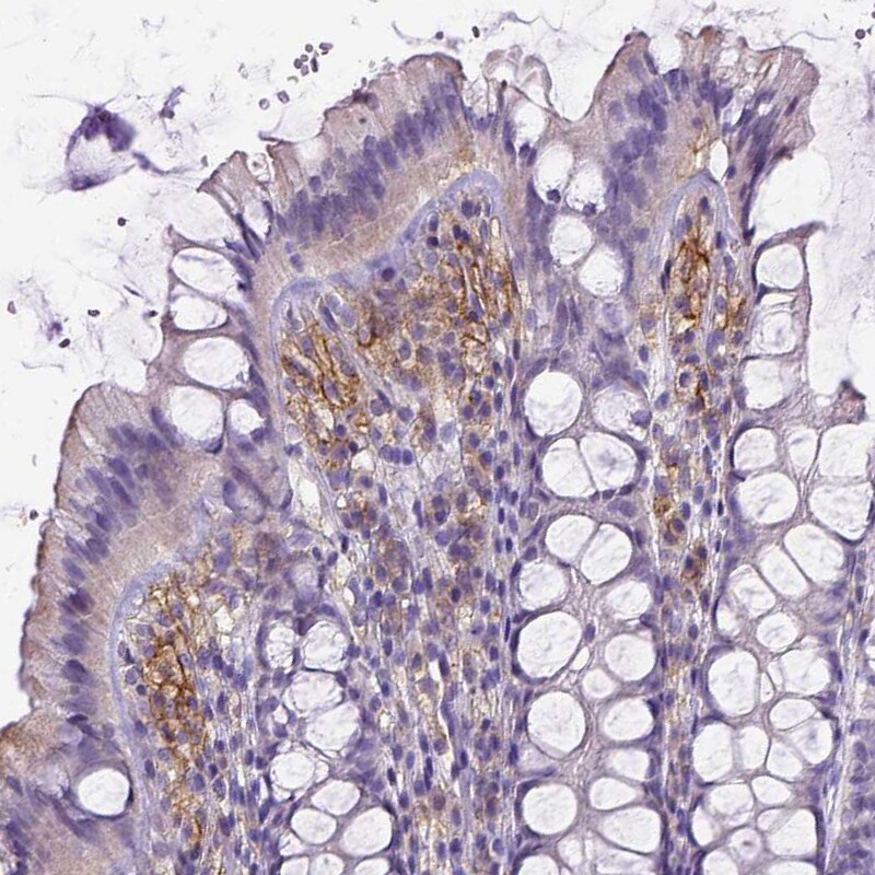 CD40/TNFRSF5 Antibody (CL1673) - Azide and BSA Free Immunohistochemistry-Paraffin: CD40/TNFRSF5 Antibody [NBP3-43956]