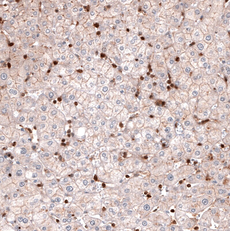 Profilin 1 Antibody (CL3524) - Azide and BSA Free Immunohistochemistry-Paraffin: Profilin 1 Antibody [NBP3-43957]