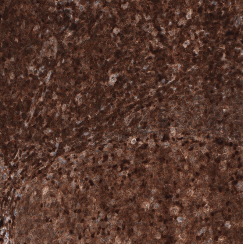 Profilin 1 Antibody (CL3524) - Azide and BSA Free Immunohistochemistry-Paraffin: Profilin 1 Antibody [NBP3-43957]