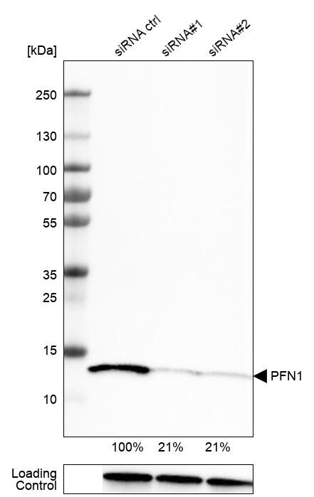 Profilin 1 Antibody (CL3524) - Azide and BSA Free Western Blot: Profilin 1 Antibody [NBP3-43957]