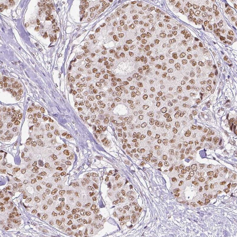 ERCC1 Antibody (CL1249) - Azide and BSA Free Immunohistochemistry-Paraffin: ERCC1 Antibody [NBP3-43959]