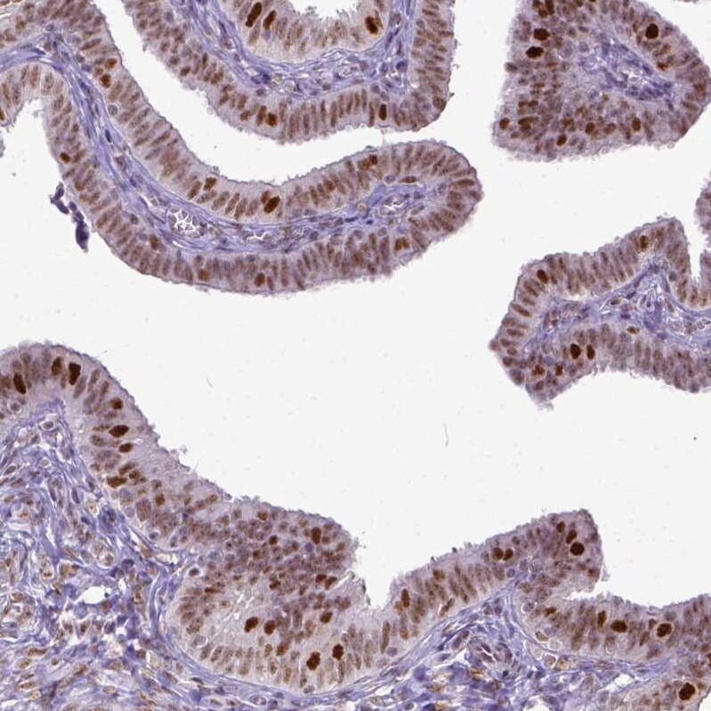 ERCC1 Antibody (CL1249) - Azide and BSA Free Immunohistochemistry-Paraffin: ERCC1 Antibody [NBP3-43959]