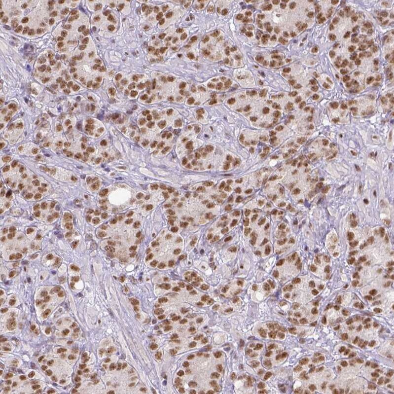 ERCC1 Antibody (CL1249) - Azide and BSA Free Immunohistochemistry-Paraffin: ERCC1 Antibody [NBP3-43959]