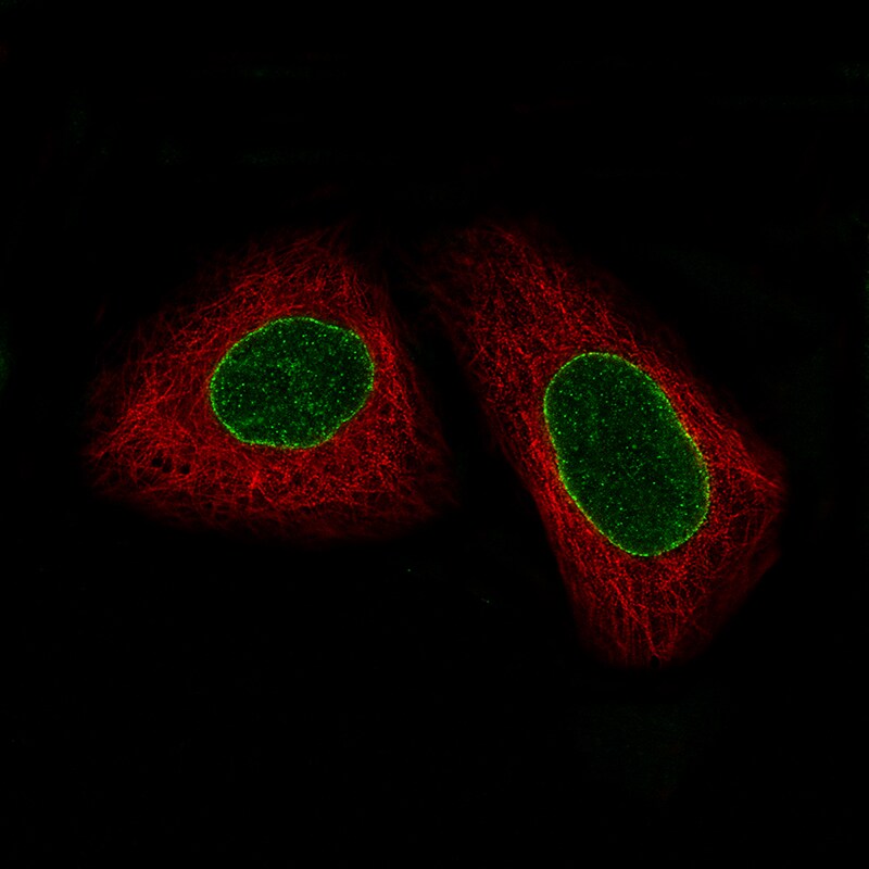 ERCC1 Antibody (CL1249) - Azide and BSA Free Immunocytochemistry/ Immunofluorescence: ERCC1 Antibody [NBP3-43959]