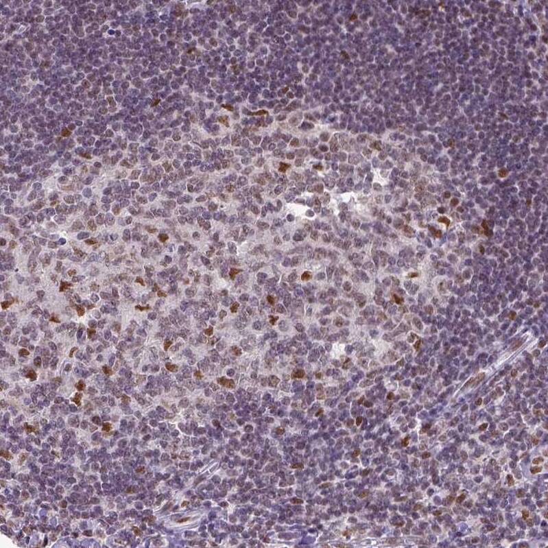 ERCC1 Antibody (CL1249) - Azide and BSA Free Immunohistochemistry-Paraffin: ERCC1 Antibody [NBP3-43959]