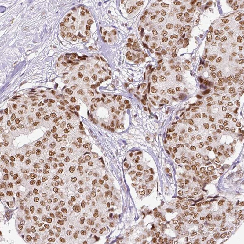 ERCC1 Antibody (CL1284) - Azide and BSA Free Immunohistochemistry-Paraffin: ERCC1 Antibody [NBP3-43960]
