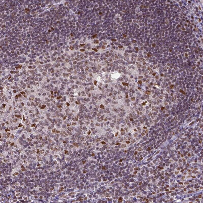 ERCC1 Antibody (CL1284) - Azide and BSA Free Immunohistochemistry-Paraffin: ERCC1 Antibody [NBP3-43960]