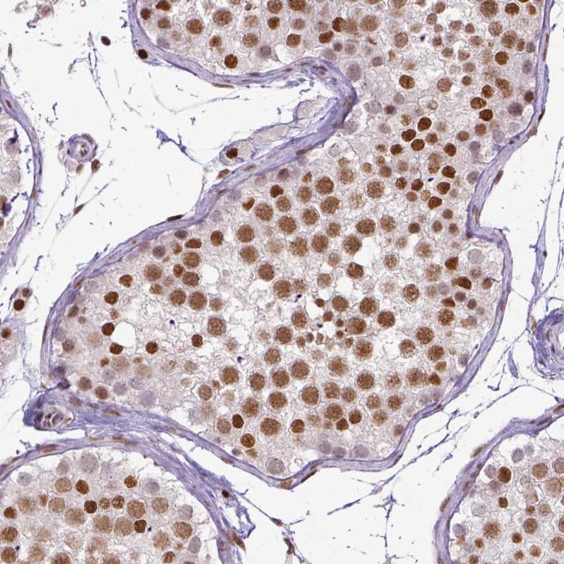 ERCC1 Antibody (CL1284) - Azide and BSA Free Immunohistochemistry-Paraffin: ERCC1 Antibody [NBP3-43960]