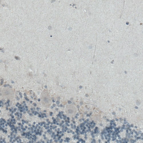 ITIH4 Antibody (CL1858) - Azide and BSA Free Immunohistochemistry-Paraffin: ITIH4 Antibody [NBP3-43963]