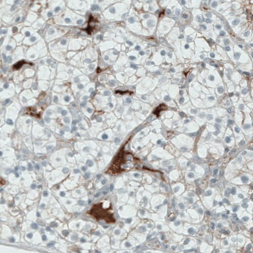 ITIH4 Antibody (CL1858) - Azide and BSA Free Immunohistochemistry-Paraffin: ITIH4 Antibody [NBP3-43963]
