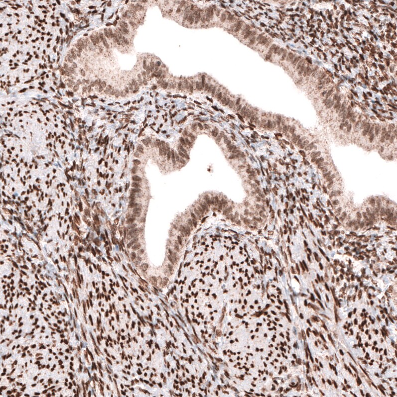 CDP/CUTL1 Antibody (CL5275) - Azide and BSA Free Immunohistochemistry-Paraffin: CDP/CUTL1 Antibody [NBP3-43964]