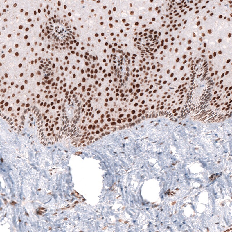 CDP/CUTL1 Antibody (CL5275) - Azide and BSA Free Immunohistochemistry-Paraffin: CDP/CUTL1 Antibody [NBP3-43964]