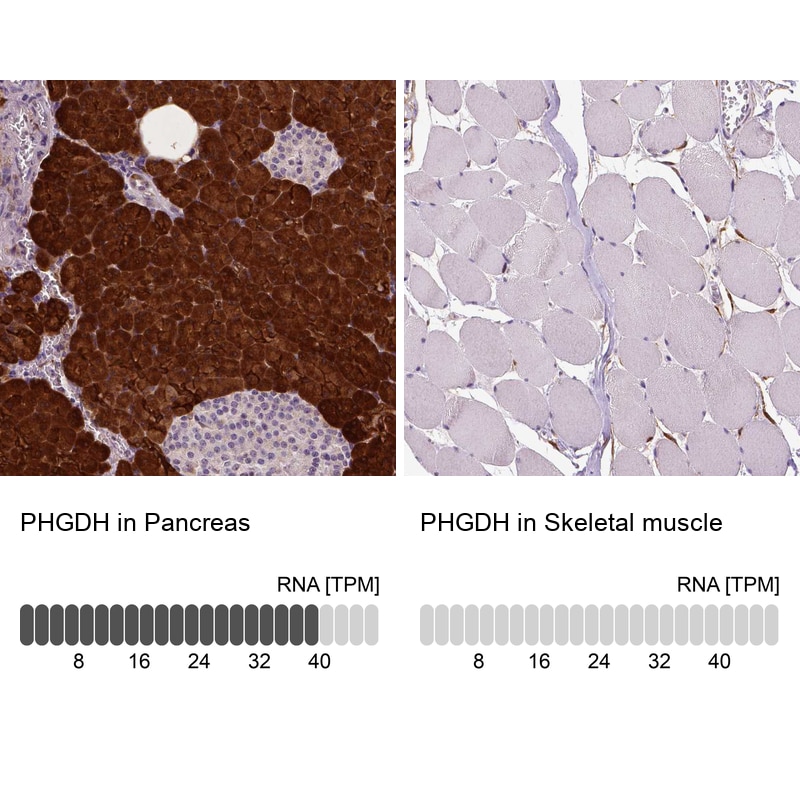 PHGDH Antibody (CL0555) - Azide and BSA Free Immunohistochemistry-Paraffin: PHGDH Antibody [NBP3-43966]