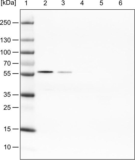 PHGDH Antibody (CL0555) - Azide and BSA Free Western Blot: PHGDH Antibody [NBP3-43966]
