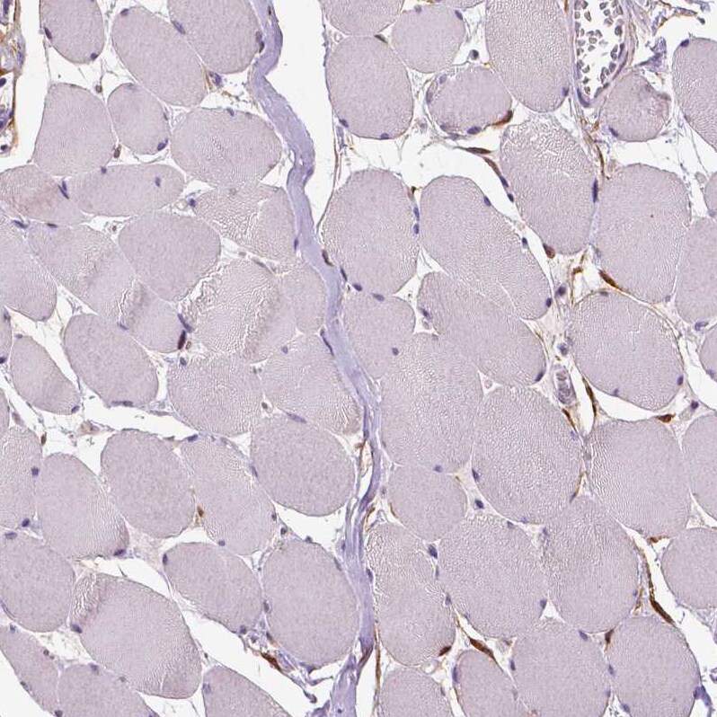PHGDH Antibody (CL0555) - Azide and BSA Free Immunohistochemistry-Paraffin: PHGDH Antibody [NBP3-43966]